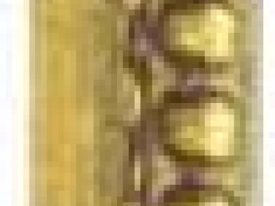 11.0424